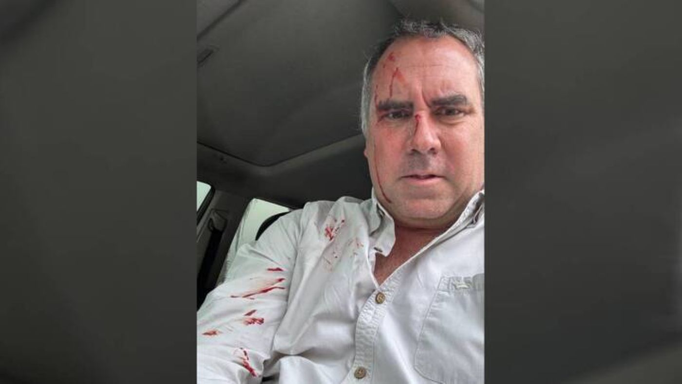 ATENTADO. Precandidato Rafael Belaunde fue atacado a balazos mientras se desplazaba en su vehículo.