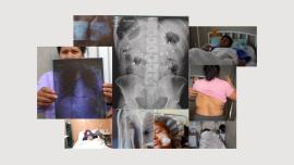 INCERTIDUMBRE. Hasta el 20 de enero, 76 heridos durante las protestas seguían hospitalizados, algunos en estado grave.  