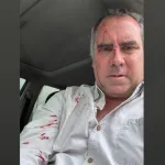 ATENTADO. Precandidato Rafael Belaunde fue atacado a balazos mientras se desplazaba en su vehículo.