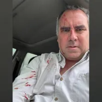 ATENTADO. Precandidato Rafael Belaunde fue atacado a balazos mientras se desplazaba en su vehículo.